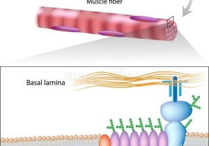 Duchenne Müsküler Distrofi (DMD)